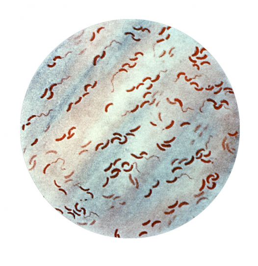 그램 얼룩, flagellated, 비 브리 오, 쉼표, 박테리아, 스트레인, cholerae, 아시아, 콜레라