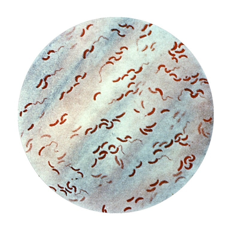 Free picture: vibrio cholerae, leifson, flagella, stain, digitally ...