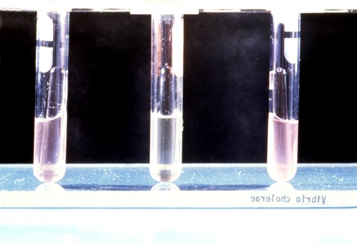 Heiberg, gæring, lab, test, isolering, identifikation, vibrio cholerae