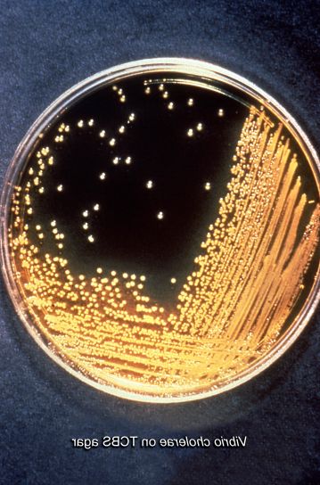 Vibrio cholerae bakterier, kolonier, thiosulfate, citrat, galde, saccharose, agar, og medium