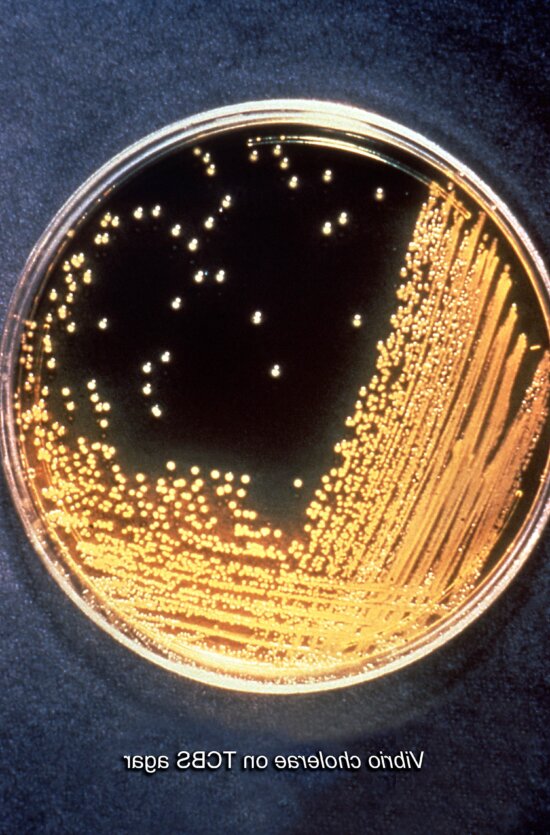 cholera bacteria gram stain