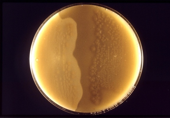 anaeróbne, baktérie, clostridium perfringens, kolónie, kultivované, antitoxín, tanier
