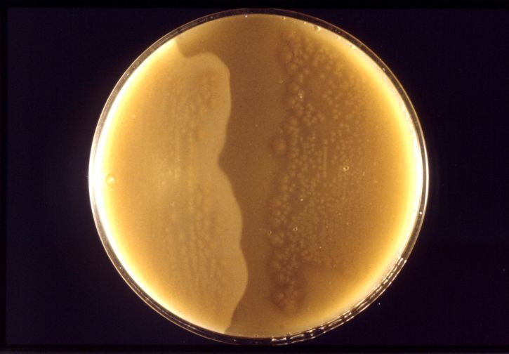 anaérobie, bactéries, clostridium perfringens, colonies, cultivé, antitoxine, plaque