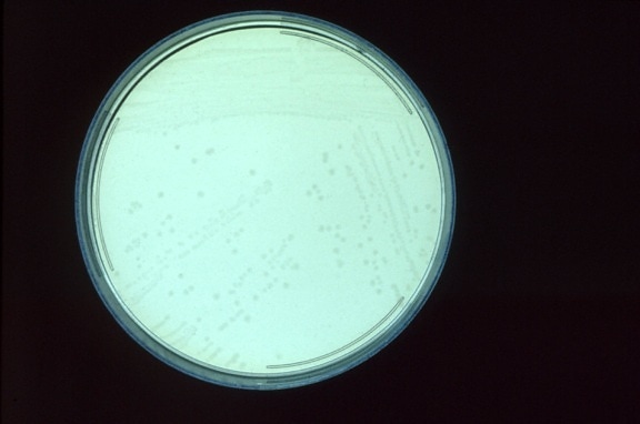 Clostridium perfringens, kolonie, kultivované, siřičitan, polymyxin, sulfadiazinu, agar, deska