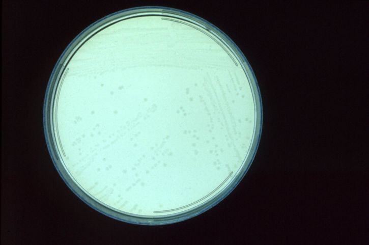 clostridium perfringens, les colonies, cultivées, le sulfite, la polymyxine, la sulfadiazine, la gélose, la plaque