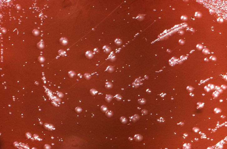 วัฒนธรรม จาน เติบ โต coli, mortiferum ผด perfringens แบคทีเรีย อาณานิคม