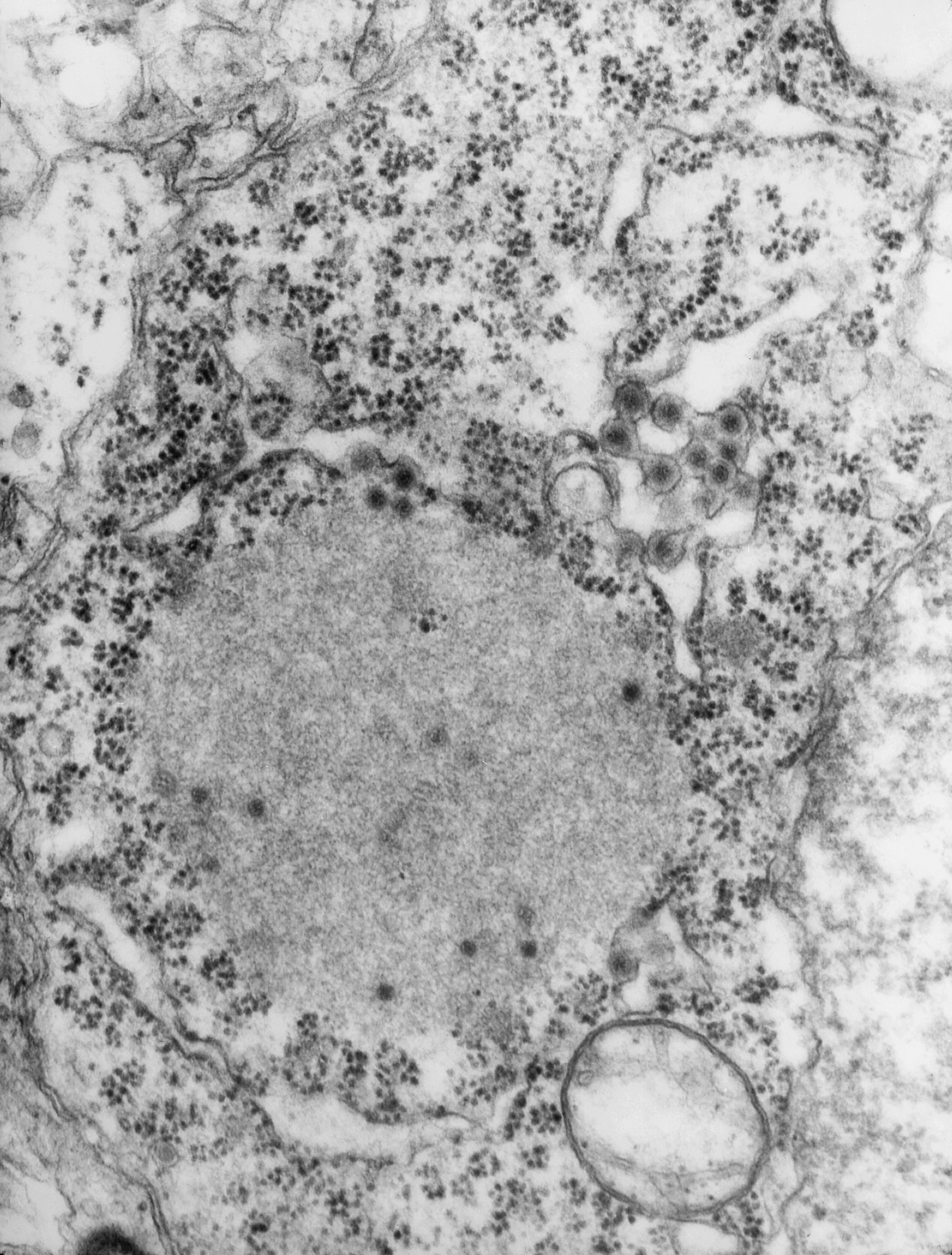 Реовирус в микроскопе. Электронная фотография парамиксовирусов. Род ephemerovirus.