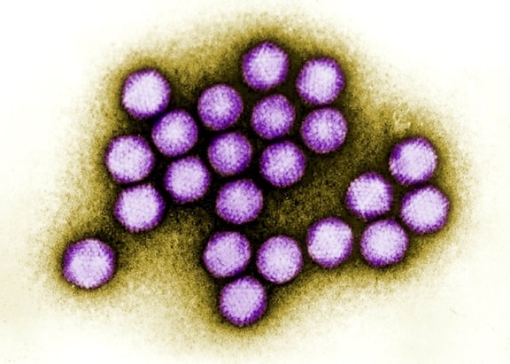 Colorized, transmisie, electron slifuri, adenovirus