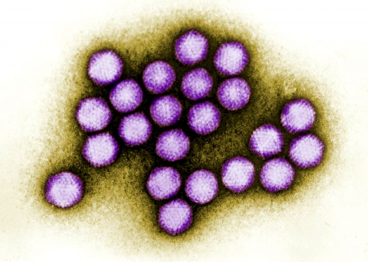 fargelegges, overføring, elektron mikroskop-bilde, adenovirus