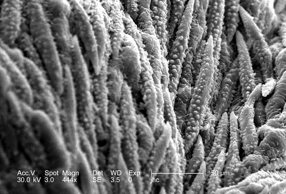 micrographie électronique, morphologiques, ultrastructurales, surface