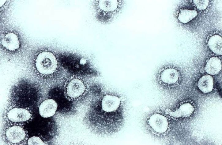 Coronavirus, oc43, wirionów