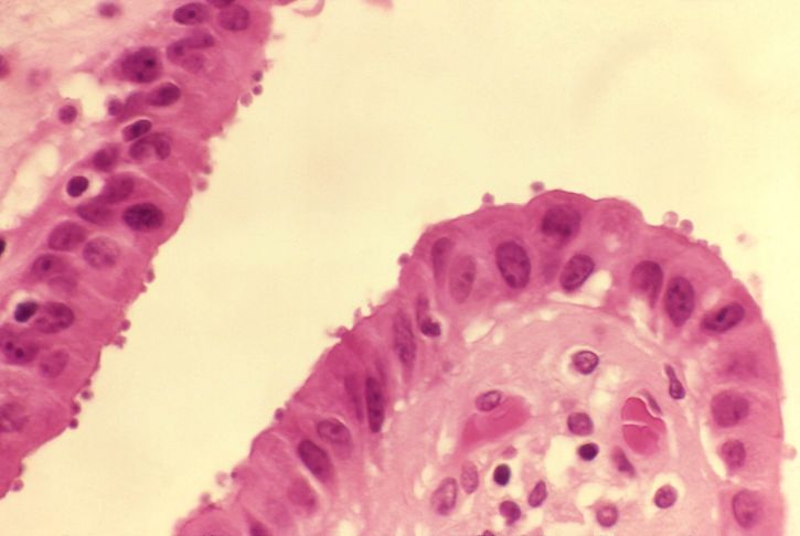 histopatologija, žučni mjehur, crijeva, pokazuje, brojne, cryptosporidium, organizama, luminalnim, površine