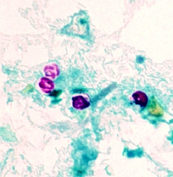 oocysts จำนวน รายละเอียดสัณฐาน parvum, photomicrograph