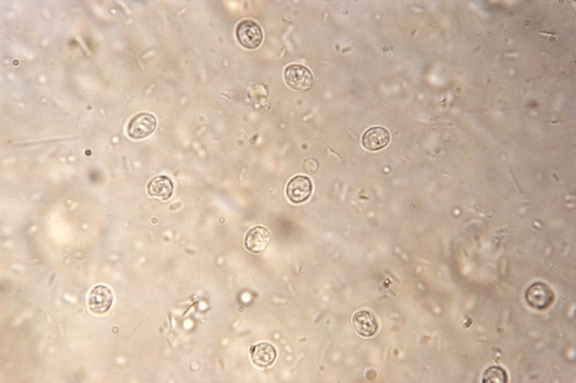 sgabello, striscio, al microscopio, rivelando, Cryptosporidium, parvum, i pazienti, criptosporidiosi