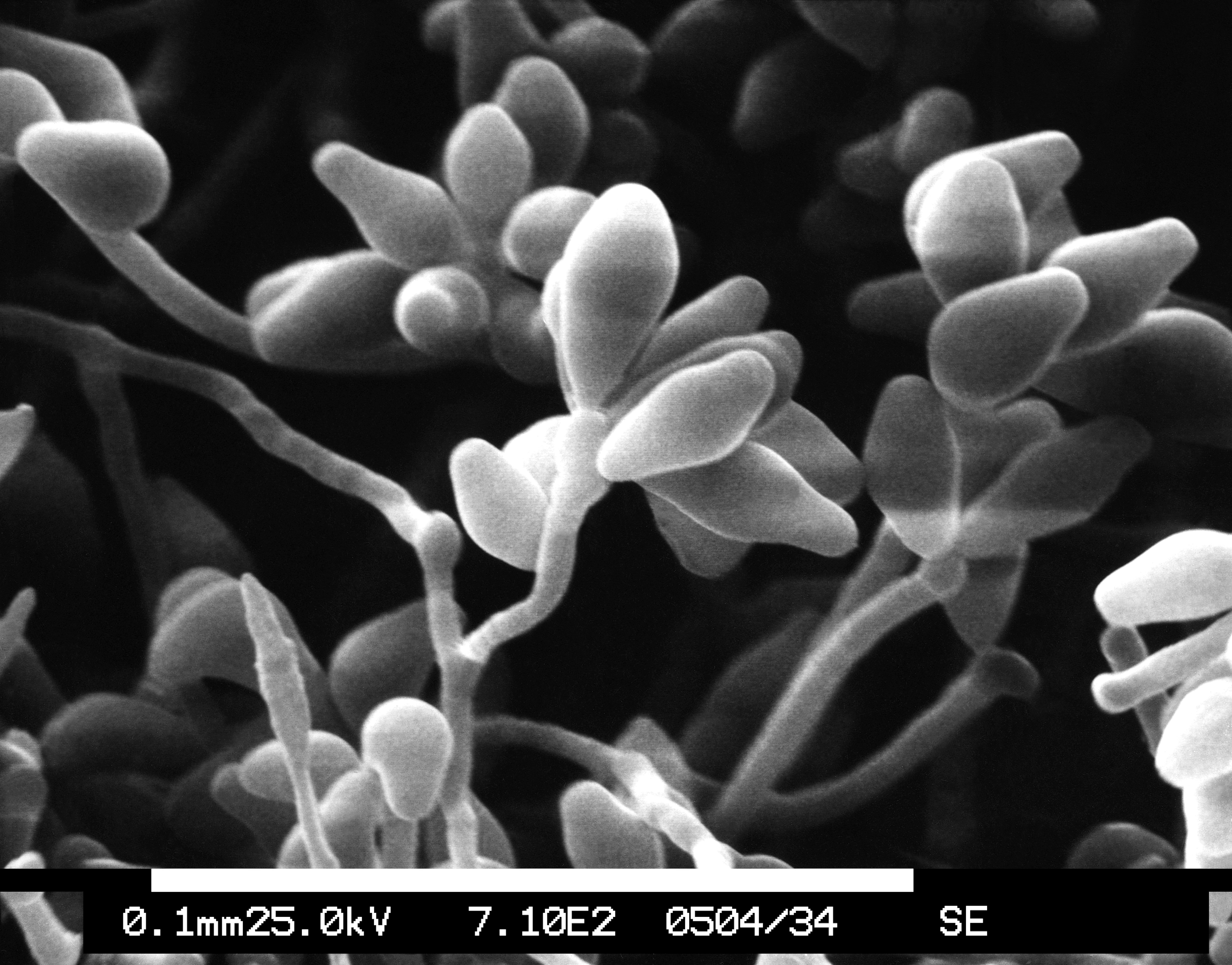 billede: dematiaceous, trådformede, svamp, curvularia, laboratorium, mikroskop, test