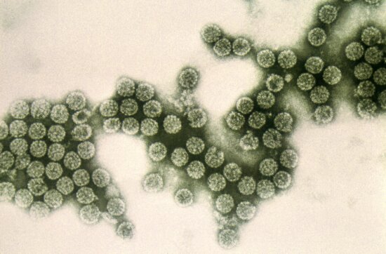 Hình ảnh Miễn Phí Paramyxovirus Bệnh Sởi Vi Rút Virions Polyomavirus Simian Vi Rút Sv40