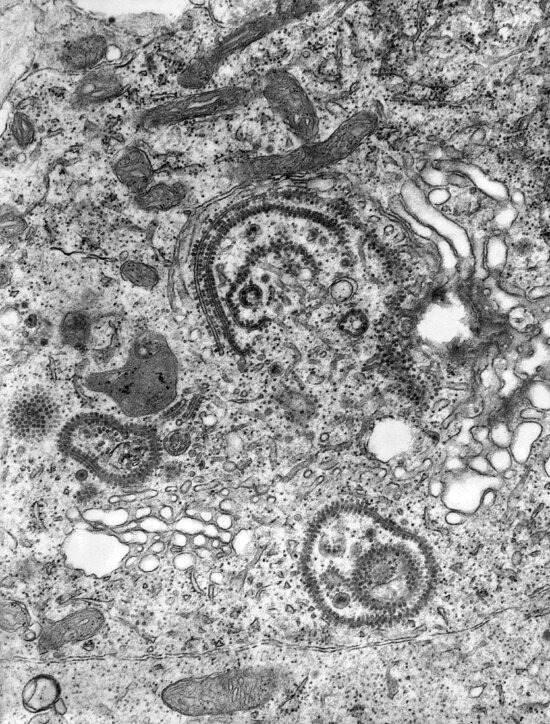 Free picture: electron micrograph, equine, encephalitis, virus ...