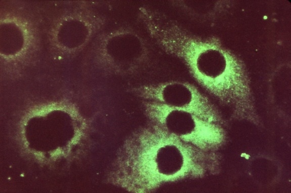 rubella, virus, classified, togavirus, genus, rubivirus