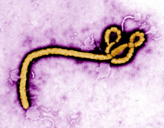 Ebola hemorrhagic fever virus