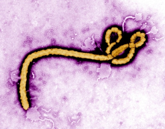 ebola, hémorragique, fièvre, virus, cellules, ebola, graves, mortels, des maladies, non humain, les primates