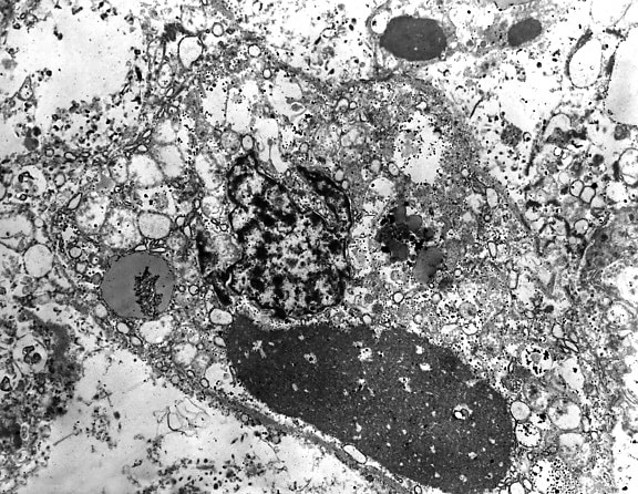 micrographie, ebola, virus, spécimen, humain, le foie, le tissu, magnifiés, 4000x