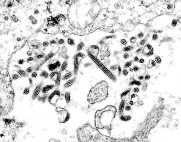 micrographie, ultrastructural, morphologie, ebola, virus