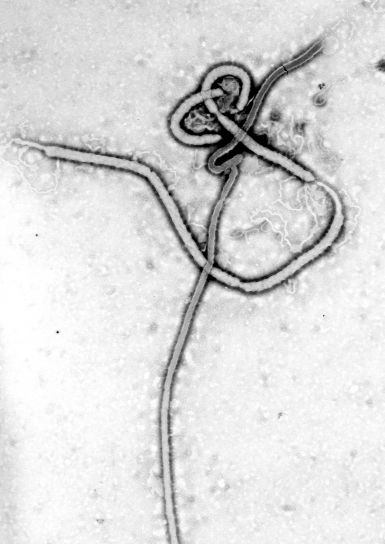 mikroskop-bilde, ultrastructural, morfologi, celler, ebola, virus, virion