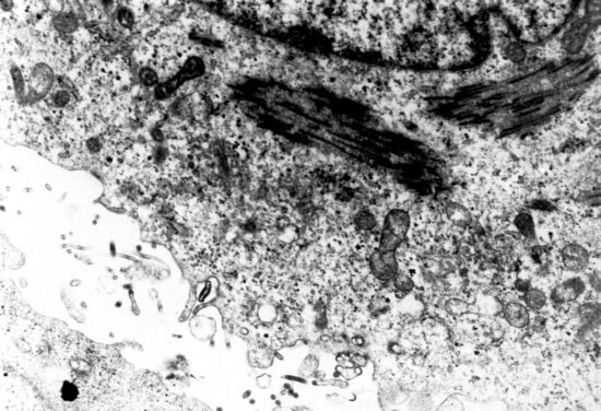 micrograph, shows, thin, section, ebola, virus