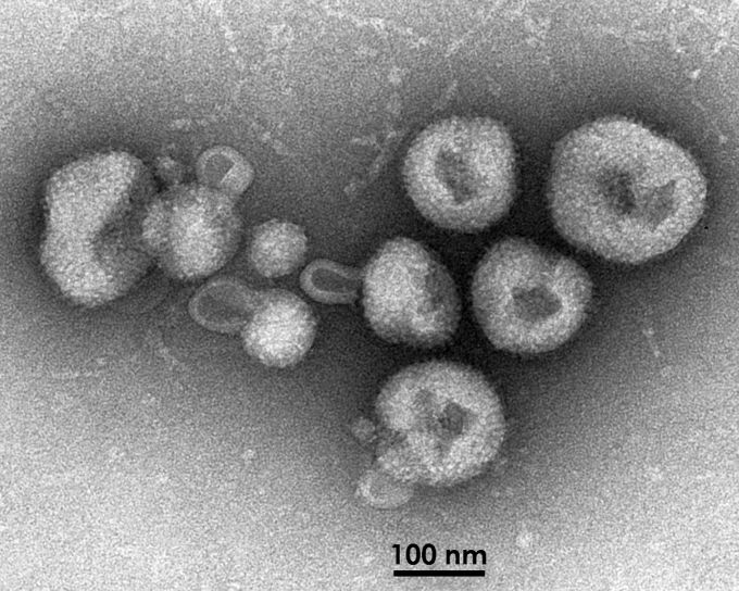 kulaté, arenavirus, virionů, charakteristické, písečná, granulovaný, kapsidy