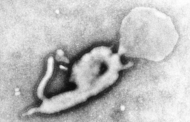 υπερδομής, μορφολογίας, χαρακτηριστικά, ο ιός Έμπολα, virion, ανακάλυψε, Λαϊκή Δημοκρατία του Κονγκό