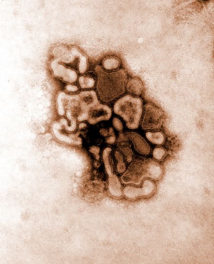 micrografía electrónica, jersey, Hsw1N1, el virus
