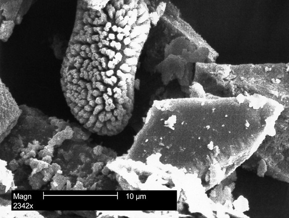 micrografía electrónica, morfológica, polen, gránulos