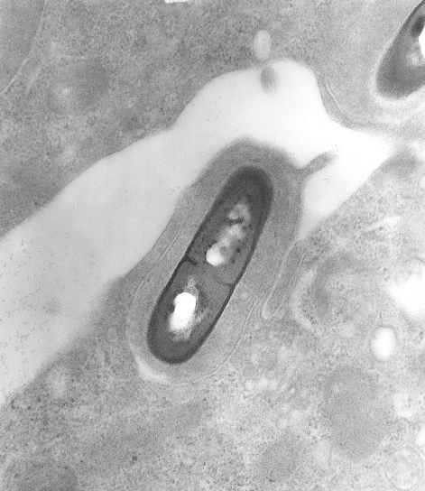 elektron mikroskop-bilde, listeria, bakterier, vev