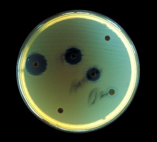แอโรบิก แบคทีเรีย escherichia coli ล้าง วุ้น จาน ยาเสพติด ความไว แสง สภาพแวดล้อมที่ไม่ใช้ออกซิเจน การทดสอบ