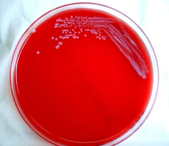 Free picture: colonies, escherichia coli, bacteria, growing, blood agar ...