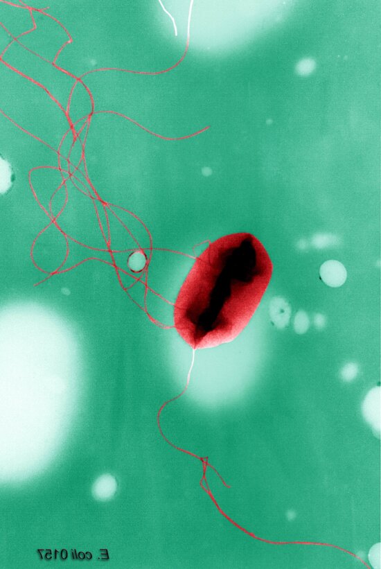 colorized, transmission, electron micrograph, escherichia coli, o157