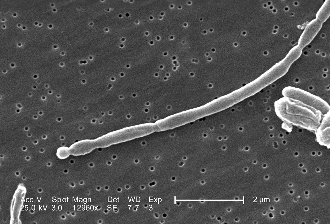 Free Picture Gram Negative Escherichia Coli Bacteria