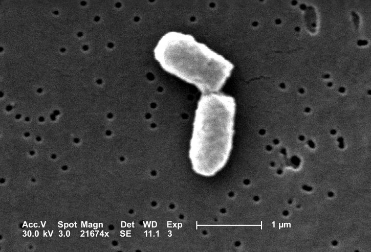ясно е, разделяне, escherichia coli, бактерии, показване, точка, бактерии, клетка, стена, разделяне