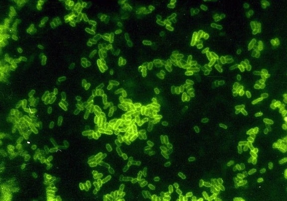 escherichia coli, spinal, fluid, stain, digitally, colorized