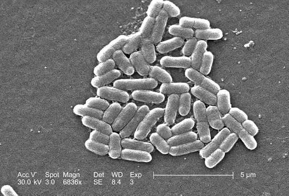 Escherichia coli, O157, auftauchen, durch Lebensmittel übertragene, Krankheit, geschätzt, 73000, Fälle, Infektion