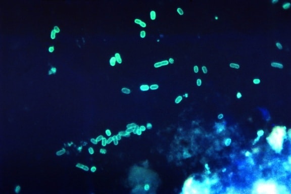 fluorescent, antibody, photomicrograph, numbers, gram, negative, enteropathogenic, escherichia coli
