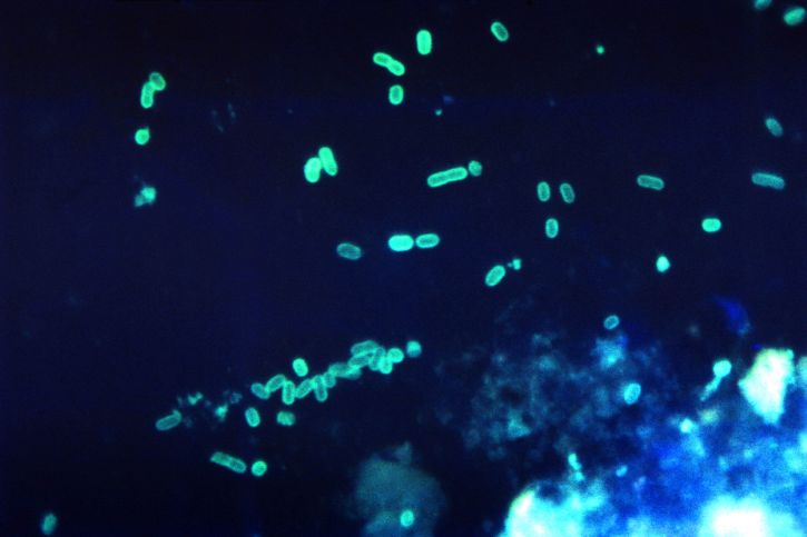 fluorescent, anticorps, microphotographie, nombres, gramme, négatif, entéropathogènes, escherichia coli