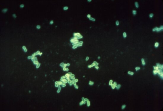 Imagem gratuita: Escherichia coli, medula espinal, mancha, coloridas ...