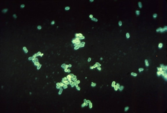 fluorescent, antibody, photomicrograph, presence, enteropathogenic, escherichia coli, bacteria