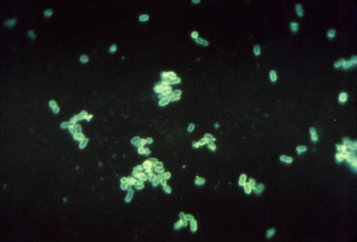 fluorescerende antistoff photomicrograph, tilstedeværelse, enteropathogenic, escherichia coli bakterier