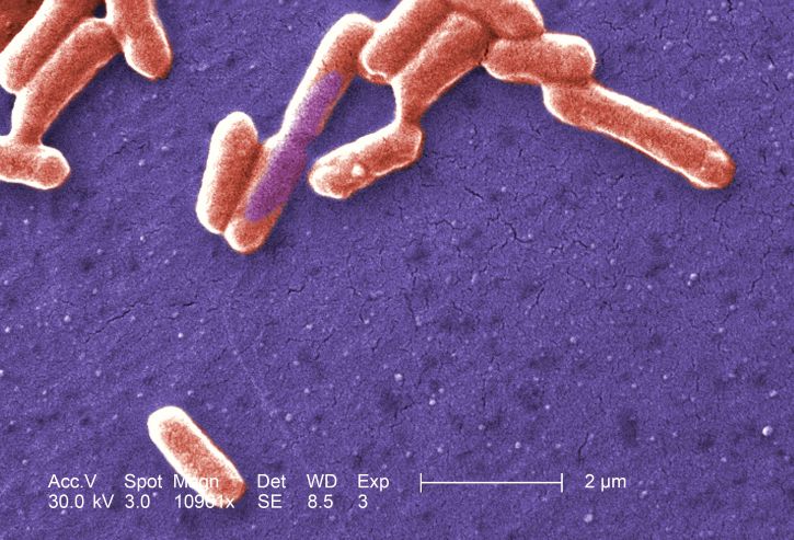 gramme, négatif, escherichia coli, bactéries, O157, Coli, O157, bactérie