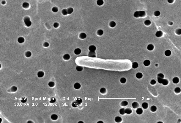 magnificada, Escherichia coli, bacterias, ampliación, 12800x