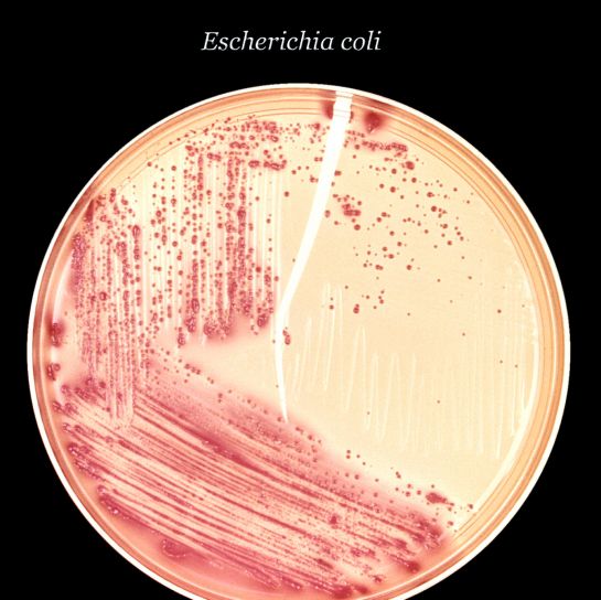 inoculated, macconkey, agar, culture, plate, colonial, growth, gram, negative, Escherichia, coli, bacteria