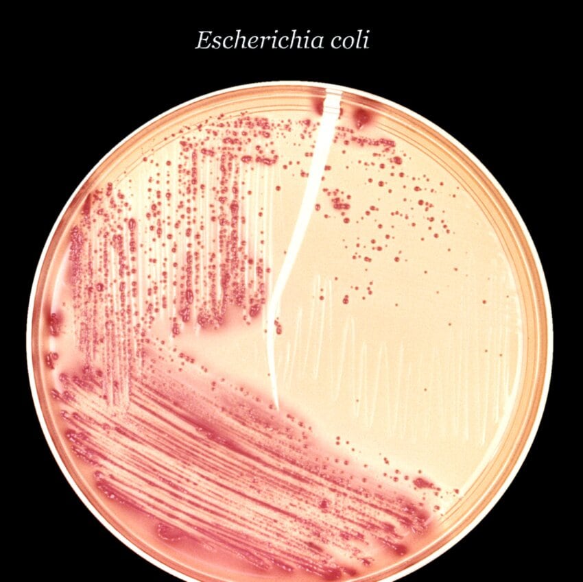 Free Picture Inoculated Macconkey Agar Culture Plate Colonial Growth Gram Negative 9537