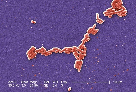 grossissement, 3418x, colorisées, micrographie, gram, négatif, Escherichia coli, des bactéries,